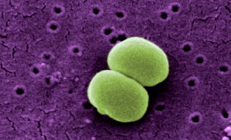 Staphylococcus Epidermidis SEM